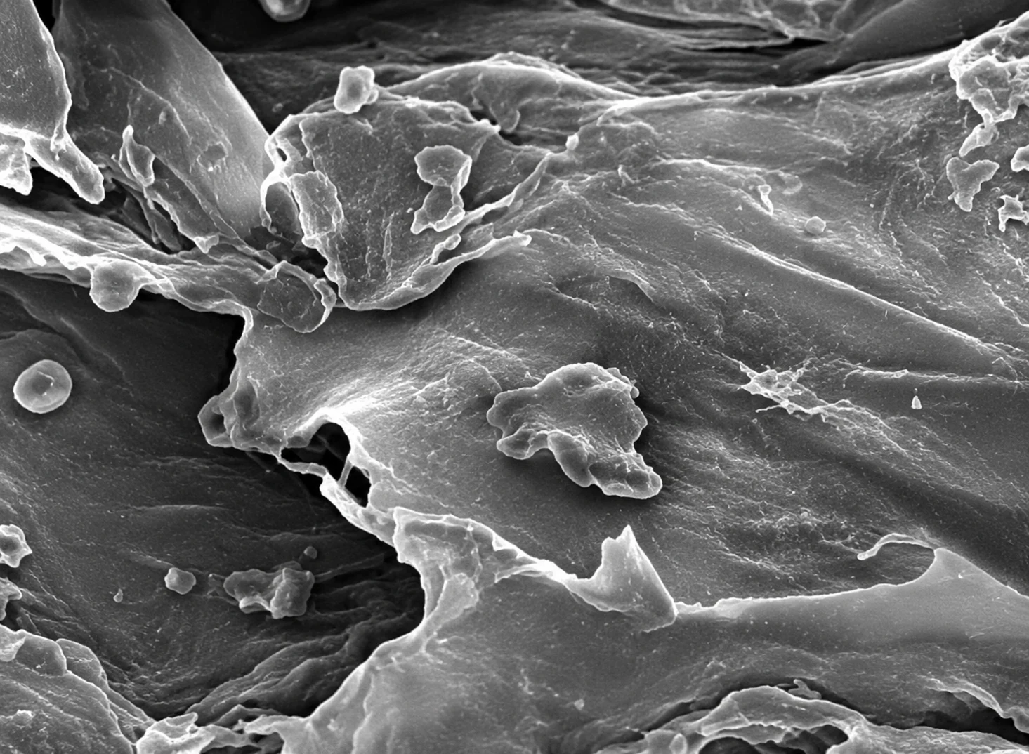 Scanning electron micrograph of mineralized collagen scaffold