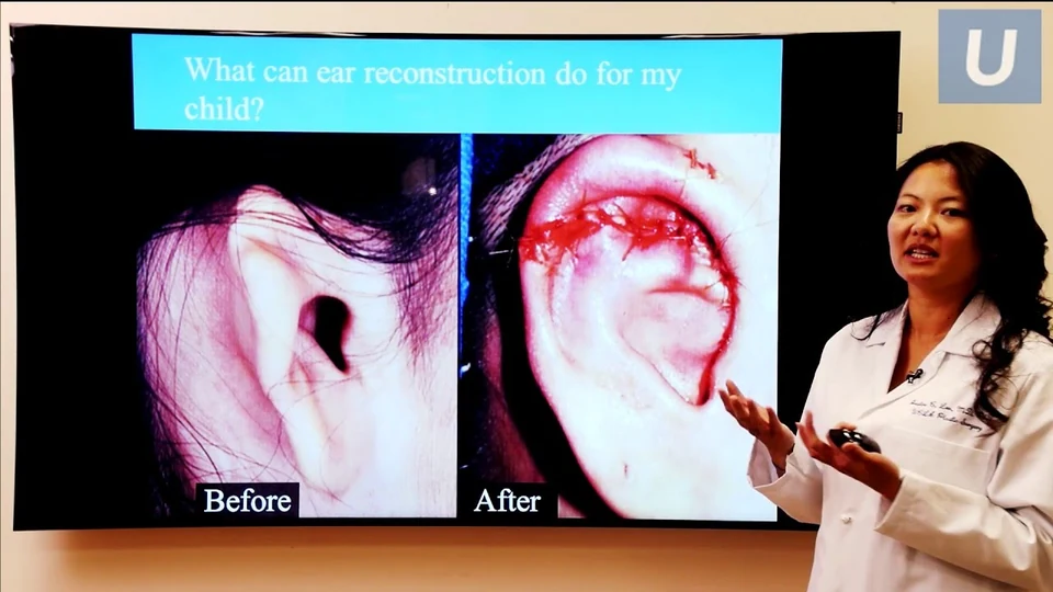 Dr. Justine Lee presenting treatment of congenital ear anomalies